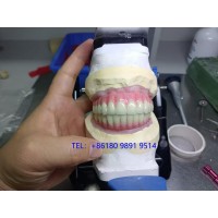 深圳種植牙Dental Implant外貿出口